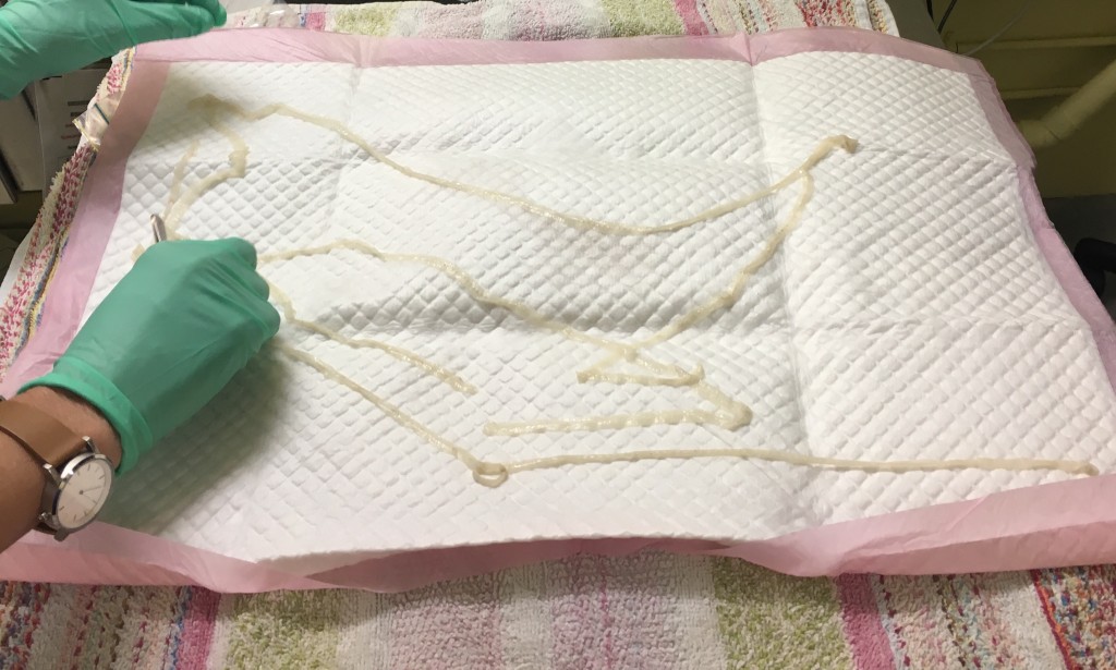 2.7m Tapeworm! Gross Video and Picture of Feline Tapeworm